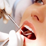 Dentistas em Santos - Thumb - Você sabe por que algumas pessoas tem cáries mesmo cuidando bem dos dentes?