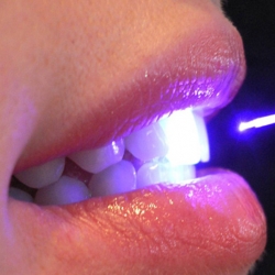 Dentistas em Santos - Laserterapia