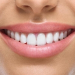 Dentistas em Santos - Thumb - Os 10 tratamentos para conseguir um sorriso como das celebridades