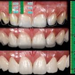Dentistas em Santos - Thumb - Planejamento Digital do Sorriso - Você precisa conhecer!