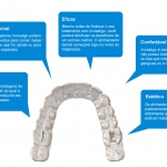 Dentistas em Santos - Thumb - Tudo sobre Invisaling, o aparelho ortodôntico invisível