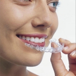 Dentistas em Santos - Thumb - Você sabia que já existe aparelho ortodôntico invisível?